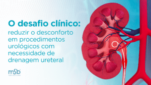 O desafio clínico: reduzir o desconforto em procedimentos urológicos com necessidade de drenagem ureteral